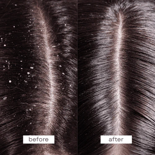 Pump Scalp Therapy Conditioner 250ml