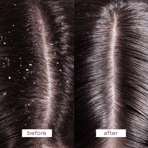 Pump scalp therapy shampoo 250ml